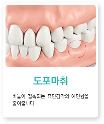 도포마취